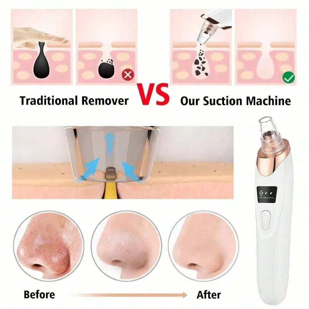 5-in-1 Rechargeable Derma Suction Blackhead Remover β Pore Vacuum Cleaner - Zafiee Mart