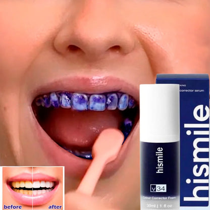Hismile V34 Tooth Whitening Mousse – Say Goodbye to Yellow Teeth! - Zafiee Mart