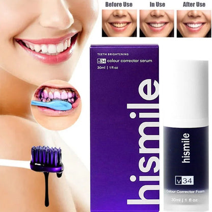 Hismile V34 Tooth Whitening Mousse – Say Goodbye to Yellow Teeth! - Zafiee Mart