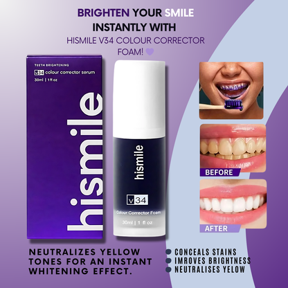 Hismile V34 Tooth Whitening Mousse – Say Goodbye to Yellow Teeth! - Zafiee Mart